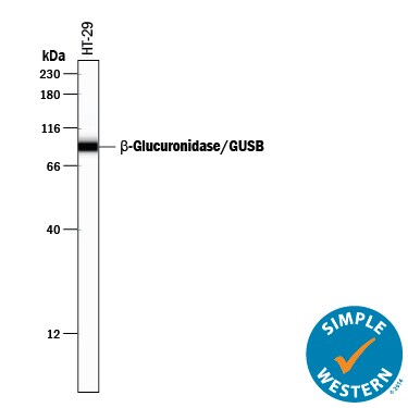 Detection of Human  beta -Glucuronidase/GUSB antibody by Simple WesternTM.