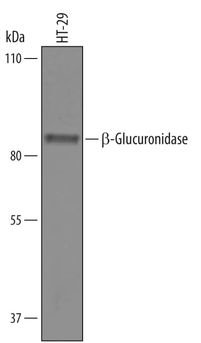 Detection of Human  beta -Glucuronidase/GUSB antibody by Western Blot.