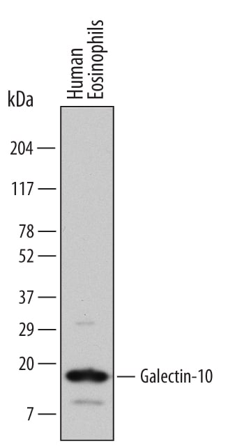 Detection of Human Galectin-10 antibody by Western Blot.