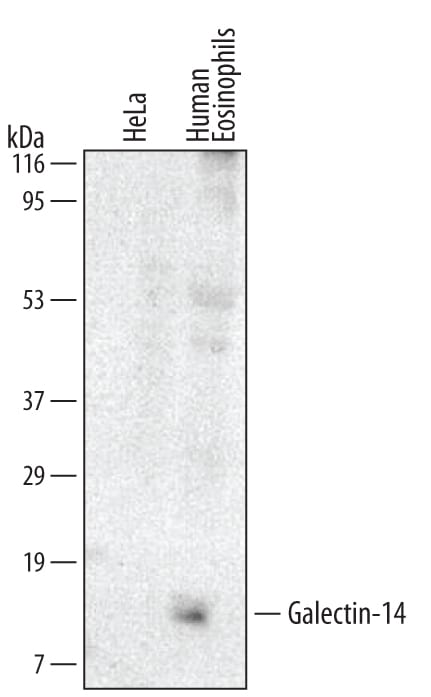 Detection of Human Galectin‑14 antibody by Western Blot.