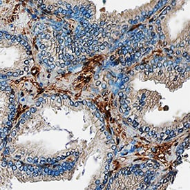 Galectin-1 antibody in Human Prostate by Immunohistochemistry (IHC-P).