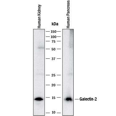 Detection of Human Galectin-2 antibody by Western Blot.