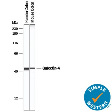 Detection of Human and Mouse Galectin-4 antibody by Simple WesternTM.