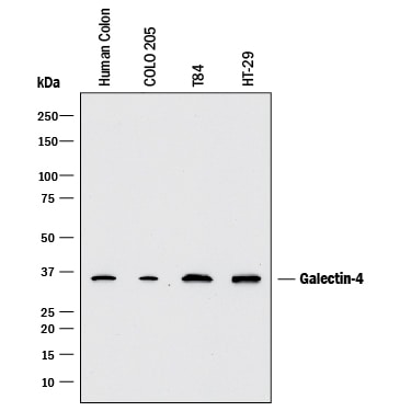 Detection of Human Galectin-4 antibody by Western Blot.