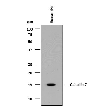 Detection of Human Galectin-7 antibody by Western Blot.