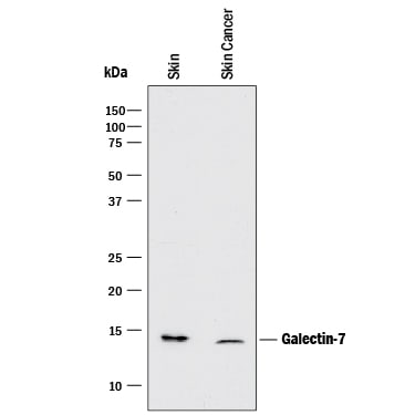 Detection of Human Galectin‑7 antibody by Western Blot.