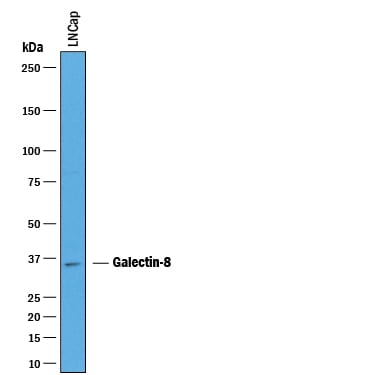 Detection of Human Galectin‑8 antibody by Western Blot.