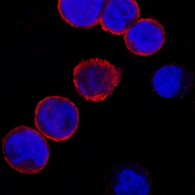 Galectin-8 antibody in U937 Human Cell Line by Immunocytochemistry (ICC).