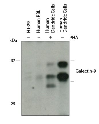 Detection of Human Galectin-9 antibody by Western Blot.