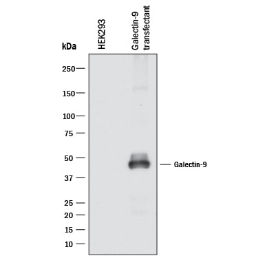 Detection of Human Galectin-9 antibody by Western Blot.