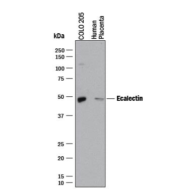 Detection of Human Galectin-9 antibody by Western Blot.