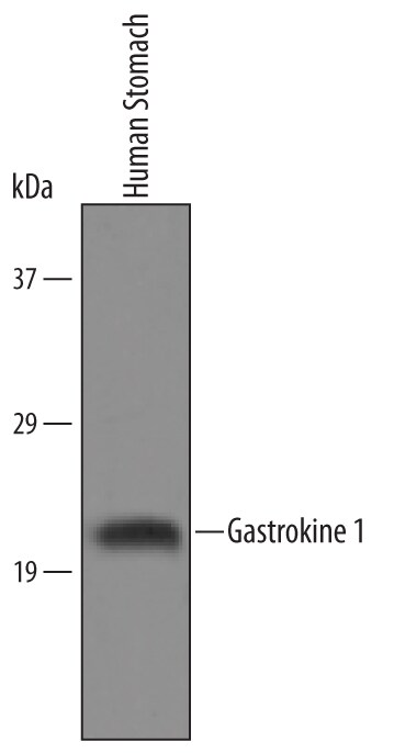 Detection of Human Gastrokine 1 antibody by Western Blot.