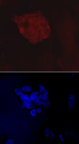 VISTA/B7-H5/PD-1H antibody in BG01V Human Embryonic Stem Cells by Immunocytochemistry (ICC).