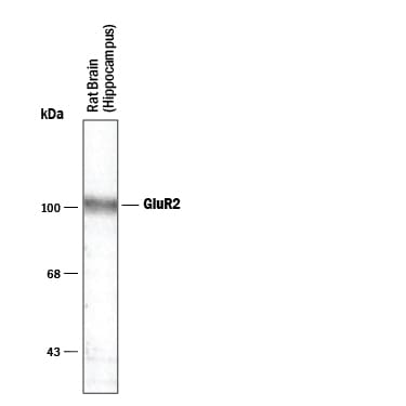 Detection of GluR2 antibody by Western Blot.