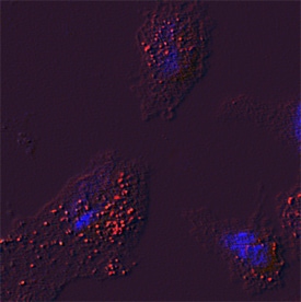 Glucosylceramidase/GBA antibody in HeLa Human Cell Line by Immunocytochemistry (ICC).