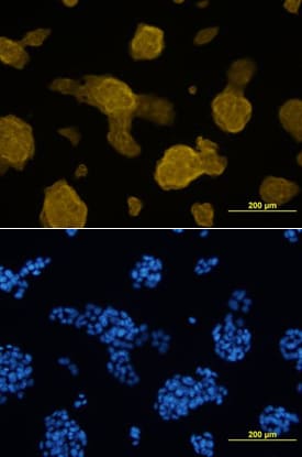 Glut2 antibody in  beta TC-6 Mouse Cell Line by Immunocytochemistry (ICC).