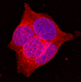 Glut2 antibody in  beta TC-6 Mouse Cell Line by Immunocytochemistry (ICC).