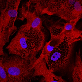 Glut4 antibody in Human Mesenchymal Stem Cells by Immunocytochemistry (ICC).
