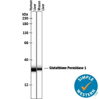 glutathione peroxidase 7 Glutathione Peroxidase 2 - an overview main image 0