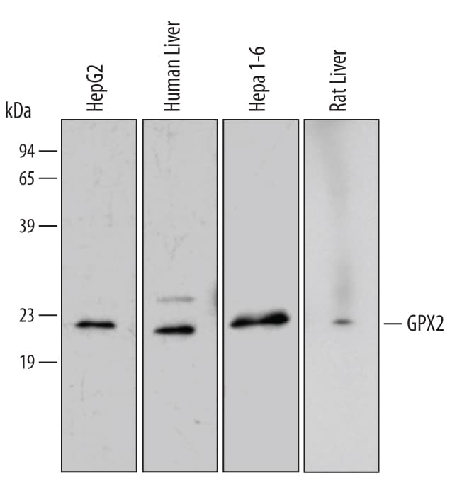 Detection of Human/Mouse/Rat Glutathione Peroxidase 2 antibody by Western Blot.