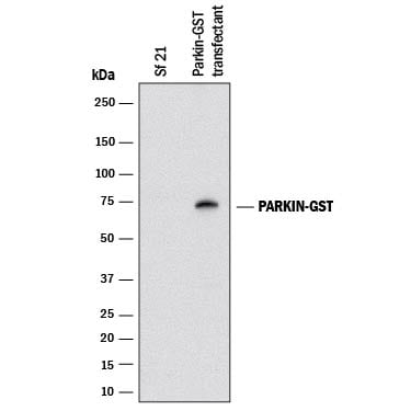 Detection of Glutathione S-Transferase/GST antibody by Western Blot.