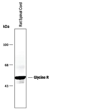 Detection of Rat Glycine R antibody by Western Blot.