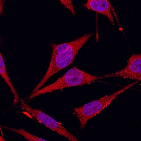 Glypican 1 antibody in MDA-MB-231 Human Cell Line by Immunocytochemistry (ICC).