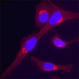 Golgi Glycoprotein 1/GLG1 antibody in PC-12 Rat Cell Line by Immunocytochemistry (ICC).