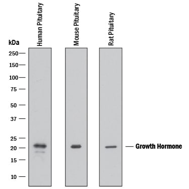 Detection of Human, Mouse, and Rat Growth Hormone antibody by Western Blot.