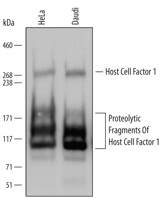 Detection of Human Host Cell Factor 1/HCFC1 antibody by Western Blot.