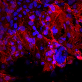 HCN4 antibody in BG01V Human Embryonic Stem Cells by Immunocytochemistry (ICC).