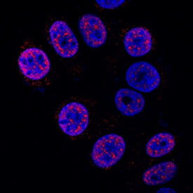 HES-1 antibody in MCF-7 Human Cell Line by Immunocytochemistry (ICC).