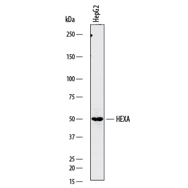Detection of Human Hexosaminidase A/ HEXA antibody by Western Blot.