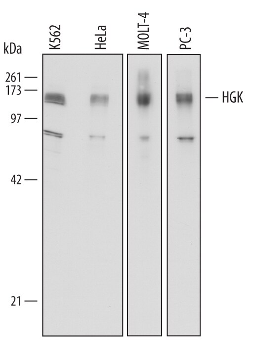 Detection of Human HGK antibody by Western Blot.