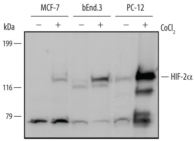 Detection of Human, Mouse, and Rat HIF-2a/EPAS1 antibody by Western Blot.