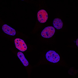 HIF-1 alpha/HIF1A antibody in MCF-7 Human Cell Line by Immunocytochemistry (ICC).