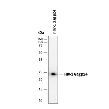Detection of HIV-1 Gag p24 antibody by Western Blot.