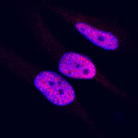 HMGB1/HMG-1 antibody in HeLa Human Cell Line by Immunocytochemistry (ICC).
