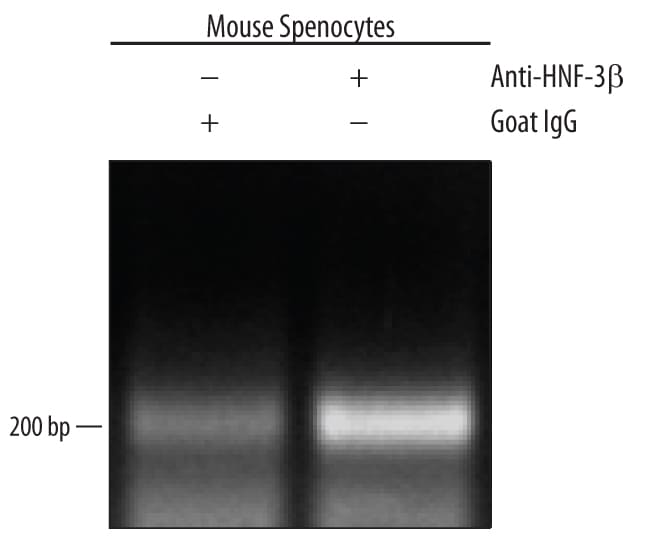 Detection of HNF-3 beta /FoxA2-regulated Genes antibody by Chromatin Immunoprecipitation.