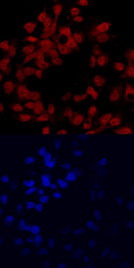 HNF-6/ONECUT1 antibody in HepG2 Human Cell Line by Immunocytochemistry (ICC).