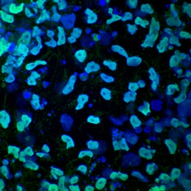 HNF-3 beta /Fox A2 antibody in Mesendoderm Differentiated BG01V Human Stem Cells by Immunocytochemistry (ICC).