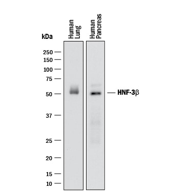 Detection of Human HNF-3 beta /FoxA2 antibody by Western Blot.