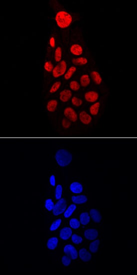 HNF-4a/NR2A1 antibody in HepG2 Human Cell Line by Immunocytochemistry (ICC).