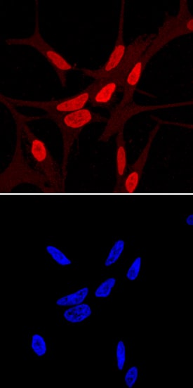 HOXB13 antibody in LNCaP Human Cell Line by Immunocytochemistry (ICC).