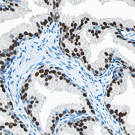 HOXB13 antibody in Human Prostate by Immunohistochemistry (IHC-P).