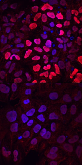 HOXB1 antibody in NTera-2 Human Cell Line by Immunocytochemistry (ICC).