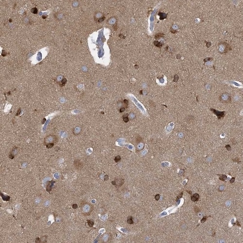 Immunohistochemistry-Paraffin: TRIM2 Antibody [NBP1-81504]