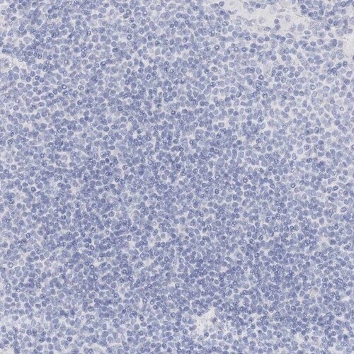 Immunohistochemistry-Paraffin: TRIM2 Antibody [NBP1-81504]