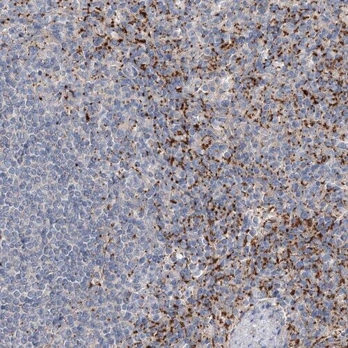 Immunohistochemistry-Paraffin: ALKBH8 Antibody [NBP1-81238]