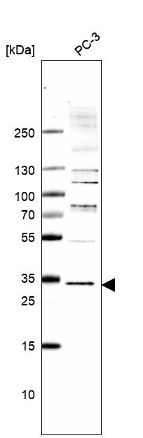 Western Blot: FAM70B Antibody [NBP1-81175]